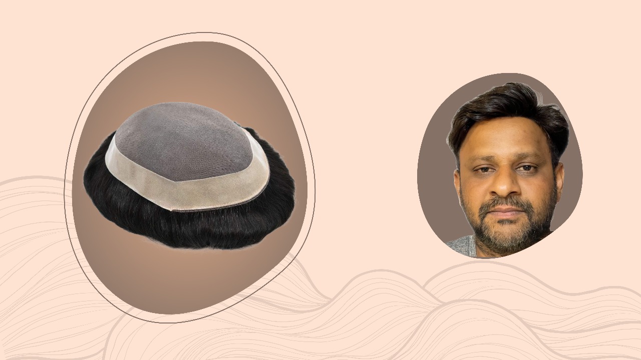 Men’s Hair Patches for Baldness